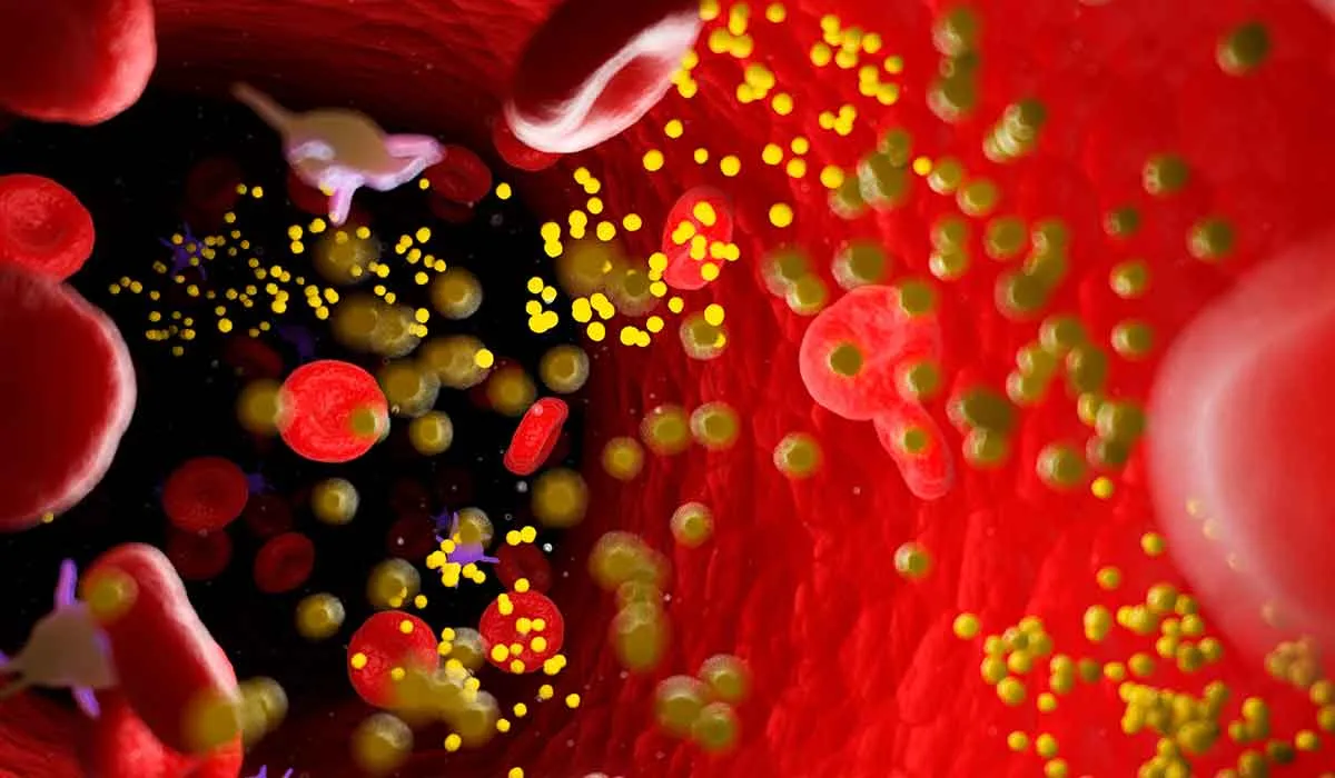 consejos para combatir el colesterol