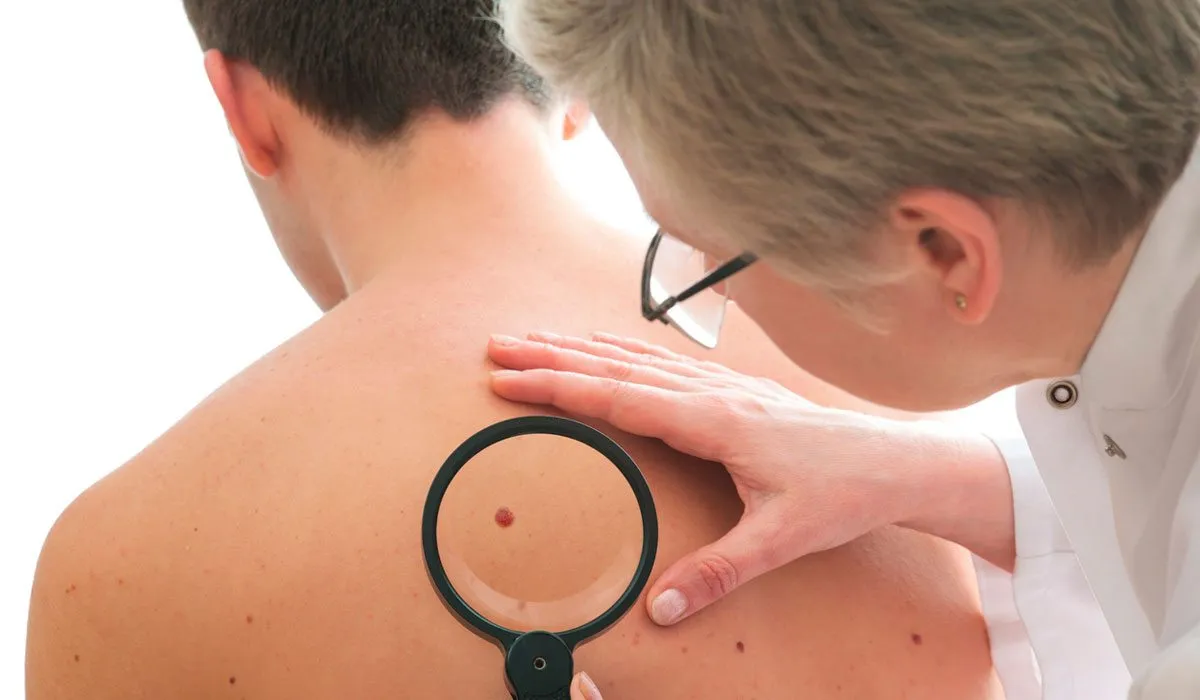 factores que provocan cáncer