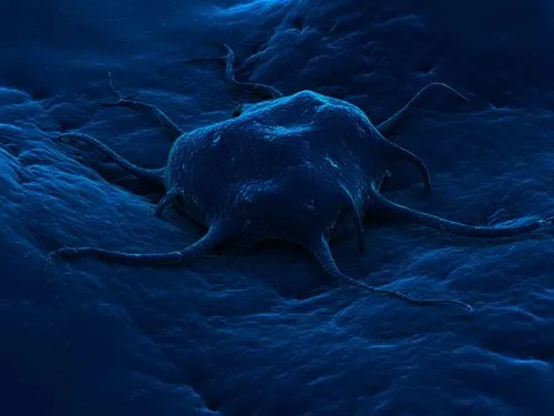 cancercolon