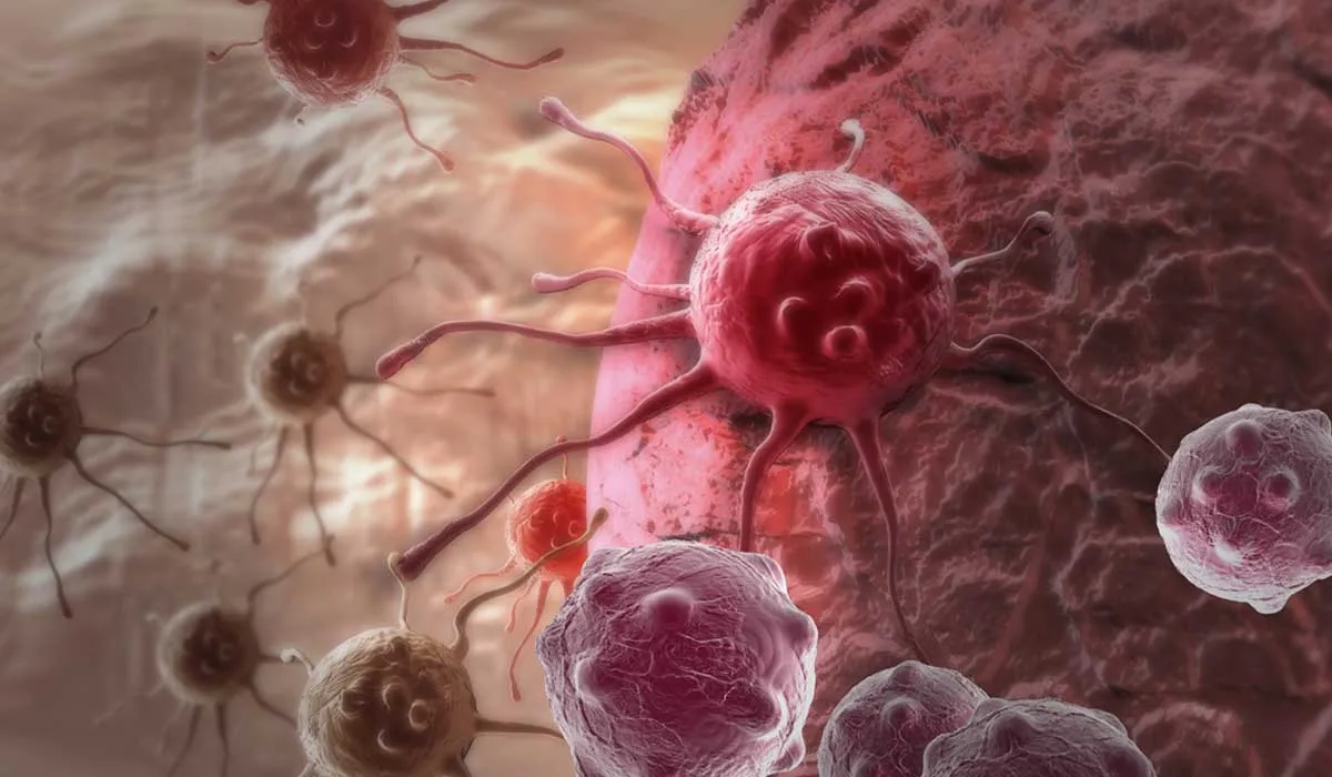 principales tipos y riesgos del cáncer