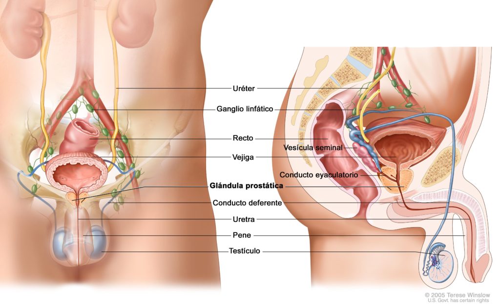 Cancer-de-prostata-sele
