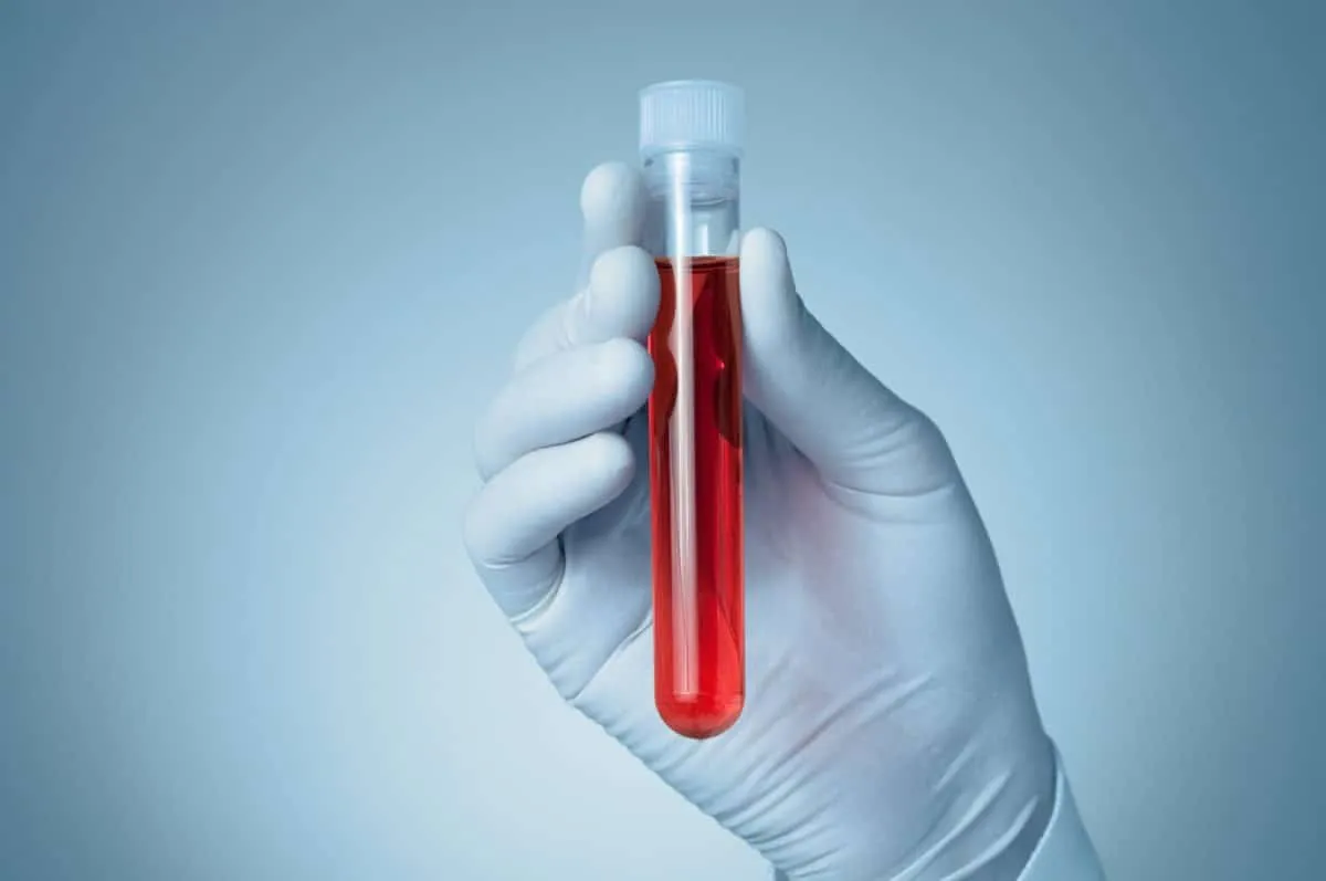 Hábitos de salud, ¡vuélvete donador de sangre!