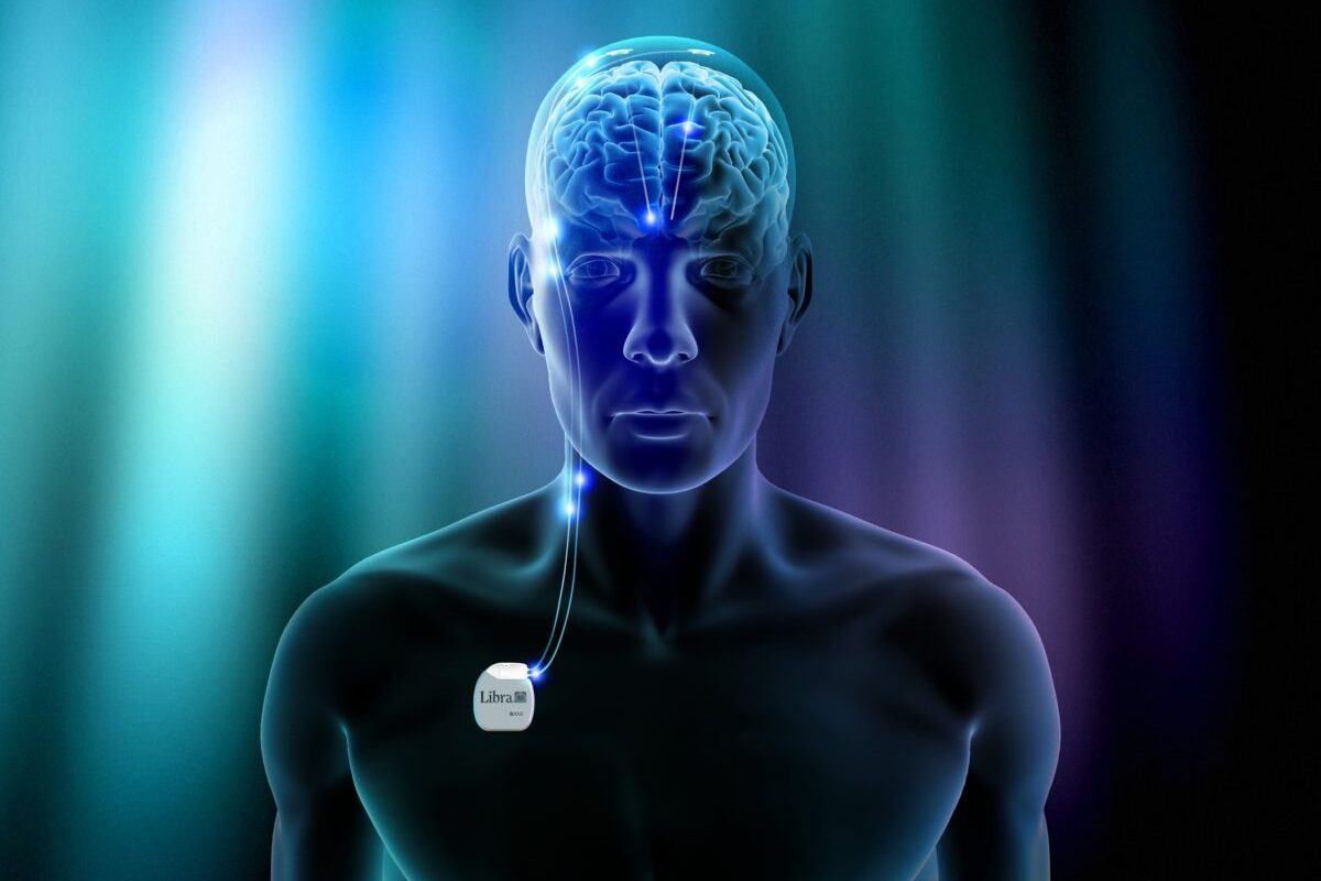 congelación cerebral7