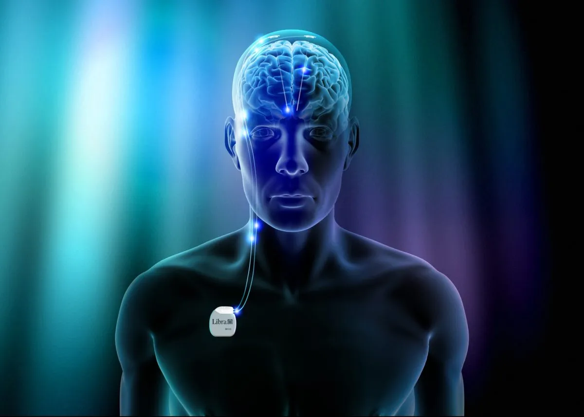 congelación cerebral7