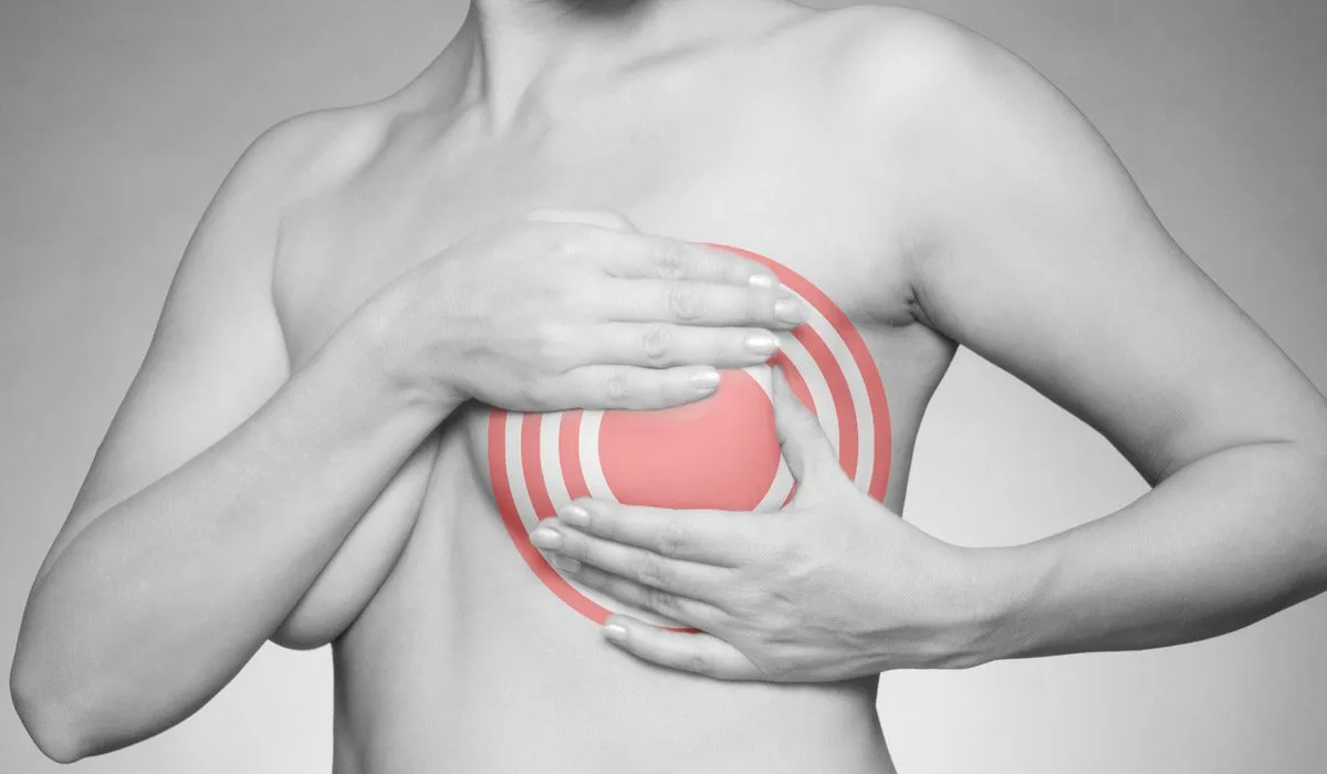 formas de evitar el cáncer de mama