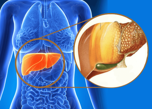 nutrición para combatir el hígado graso