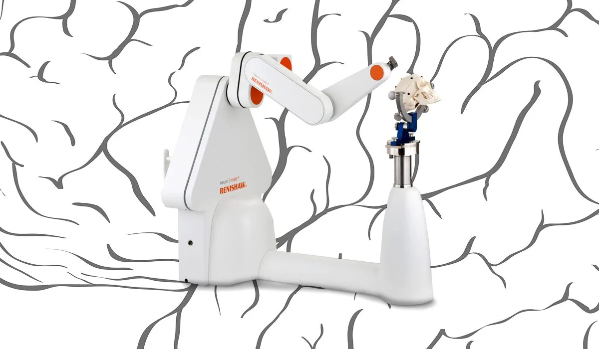 ¡Increíble! Robots que curan la epilepsia