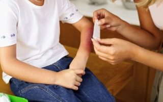 Medidas para prevenir quemaduras de niños en casa