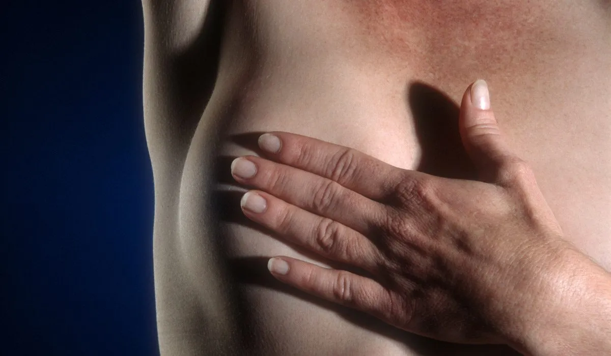 ¿A qué tengo derecho si tengo cáncer de mama?