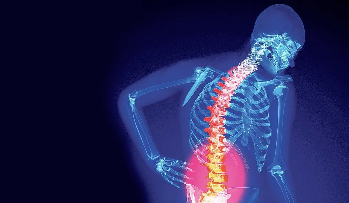 La contaminación está asociada con las fracturas
