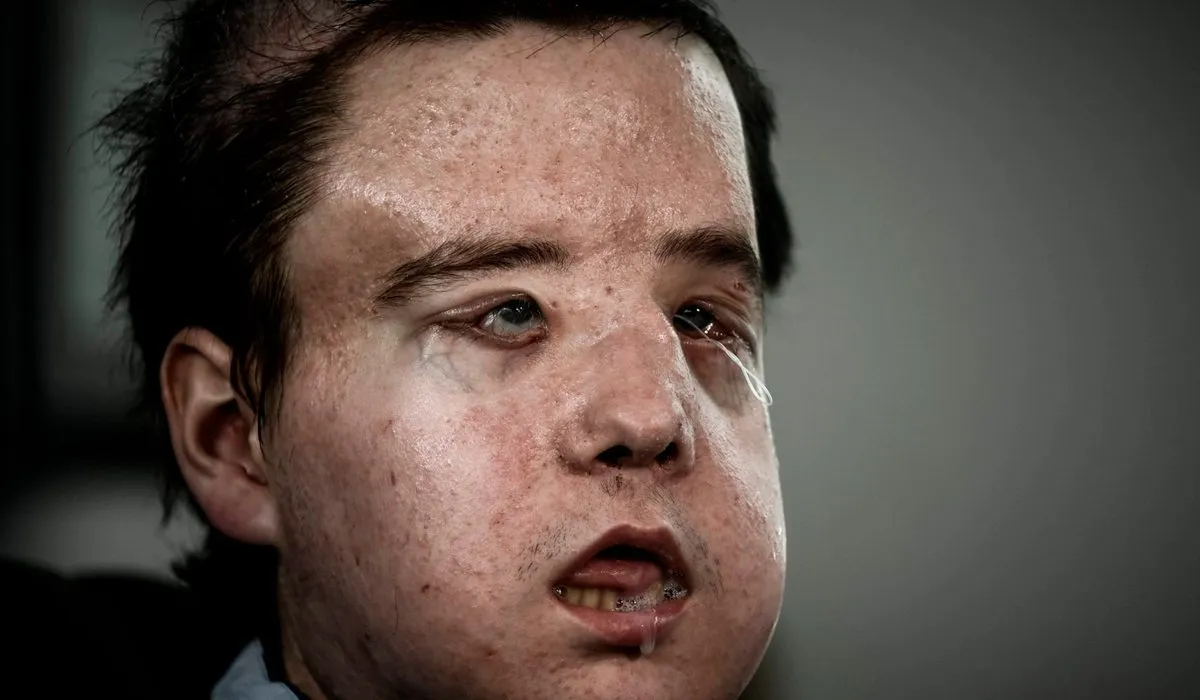 Conoce la historia del hombre de tres caras