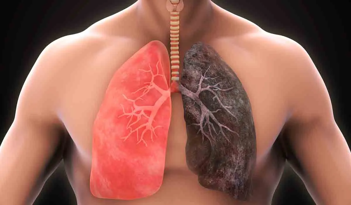 Problemas para respirar por enfermedad pulmonar obstructiva crónica
