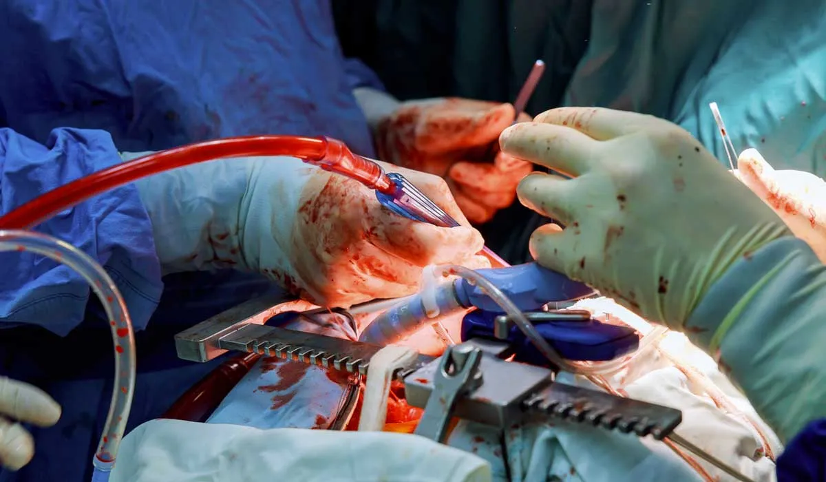 ¿Necesitas un trasplante renal? Esto podría ayudarte en corto tiempo