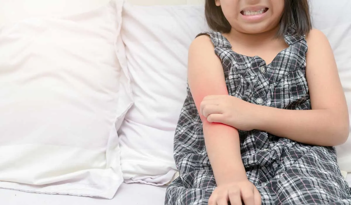 ¿Padeces dermatitis atópica? Esto te interesa