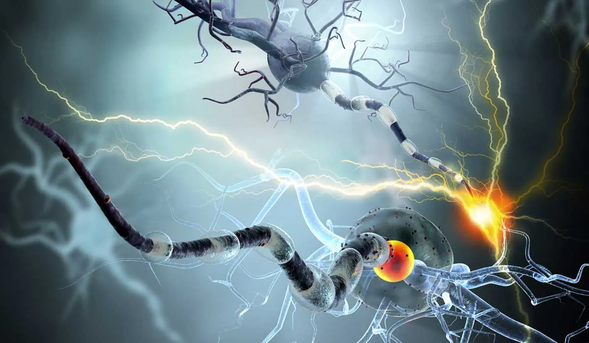 datos sobre la esclerosis multiple