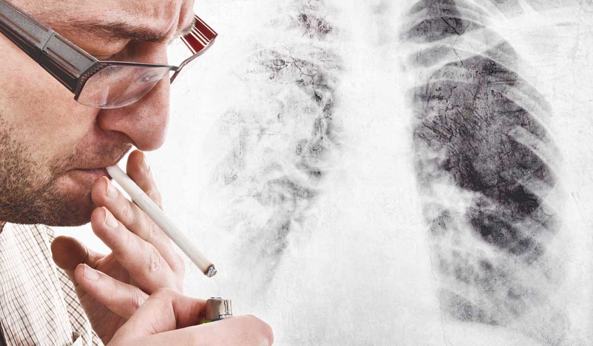 cáncer de pulmón sin haber fumado