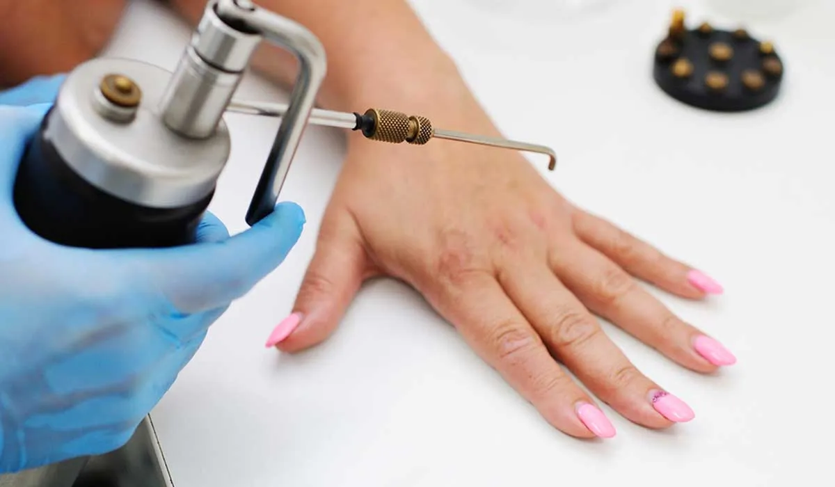 qué hacer para quitar las verrugas