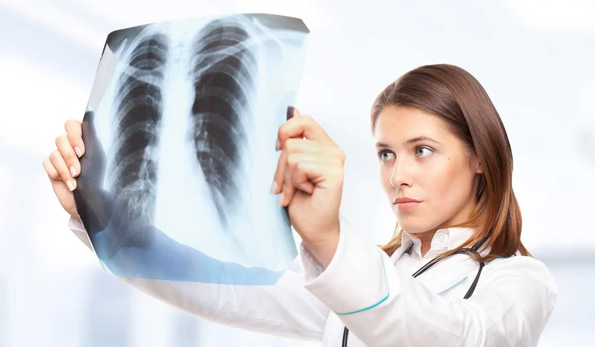no sabía que tenía cáncer de pulmón