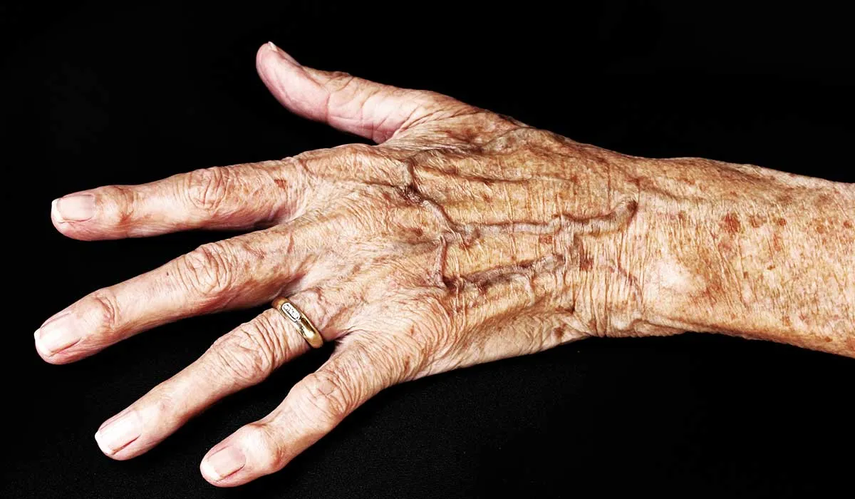 así debes cuidar la piel de los adultos mayores