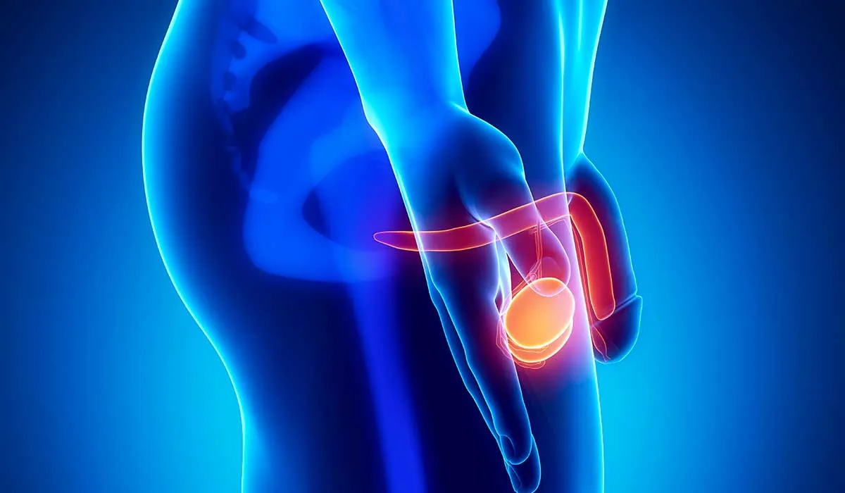 afecciones en el testículo podrían terminar en cáncer