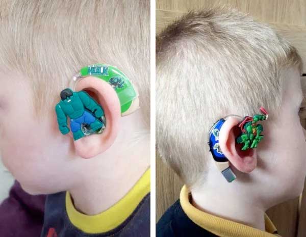 Una madre diseña audífonos para elevar la autoestima de niños con sordera