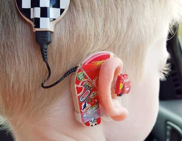 Una madre diseña audífonos para elevar la autoestima de niños con sordera