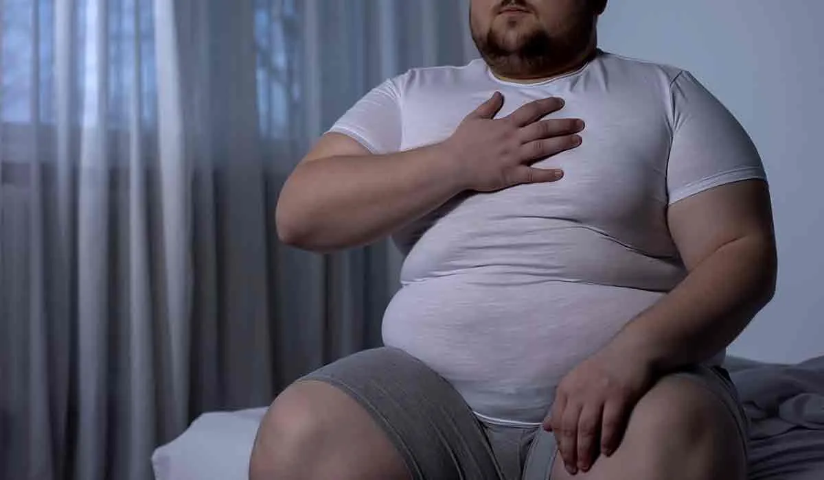 piernas hinchadas y obesidad