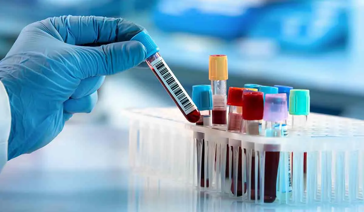 cuáles son los síntomas de la septicemia