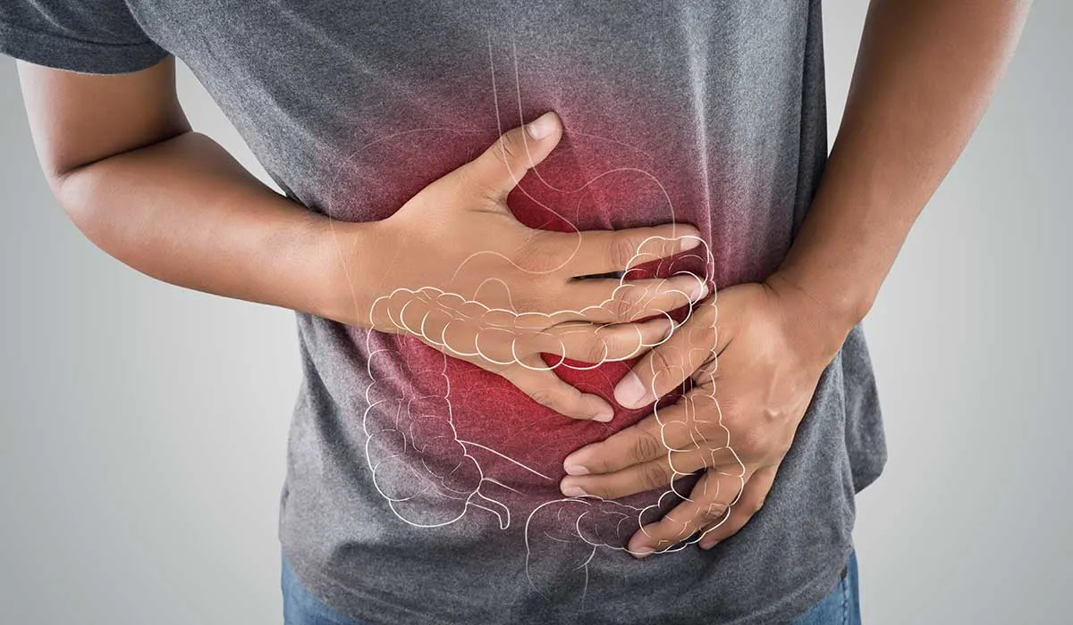 enfermedad inflamatoria intestinal