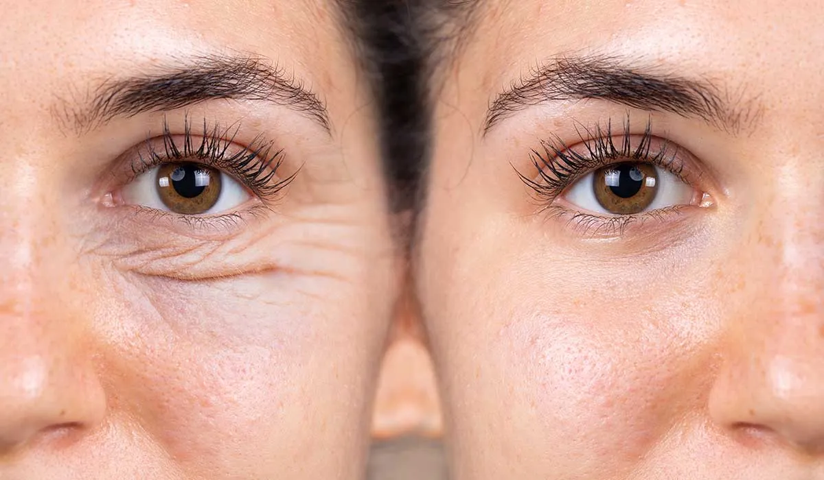 métodos no invasivos dermotermicos