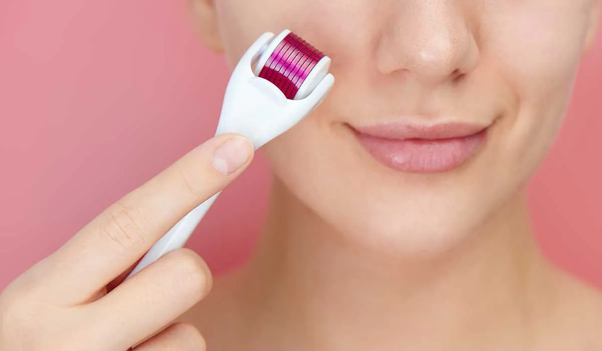 para esto sirve el microneedling