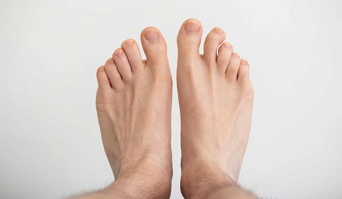 remedios caseros para uñas encarnadas