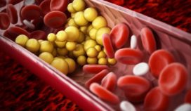 7 formas claves para reducir el colesterol sin usar medicamentos