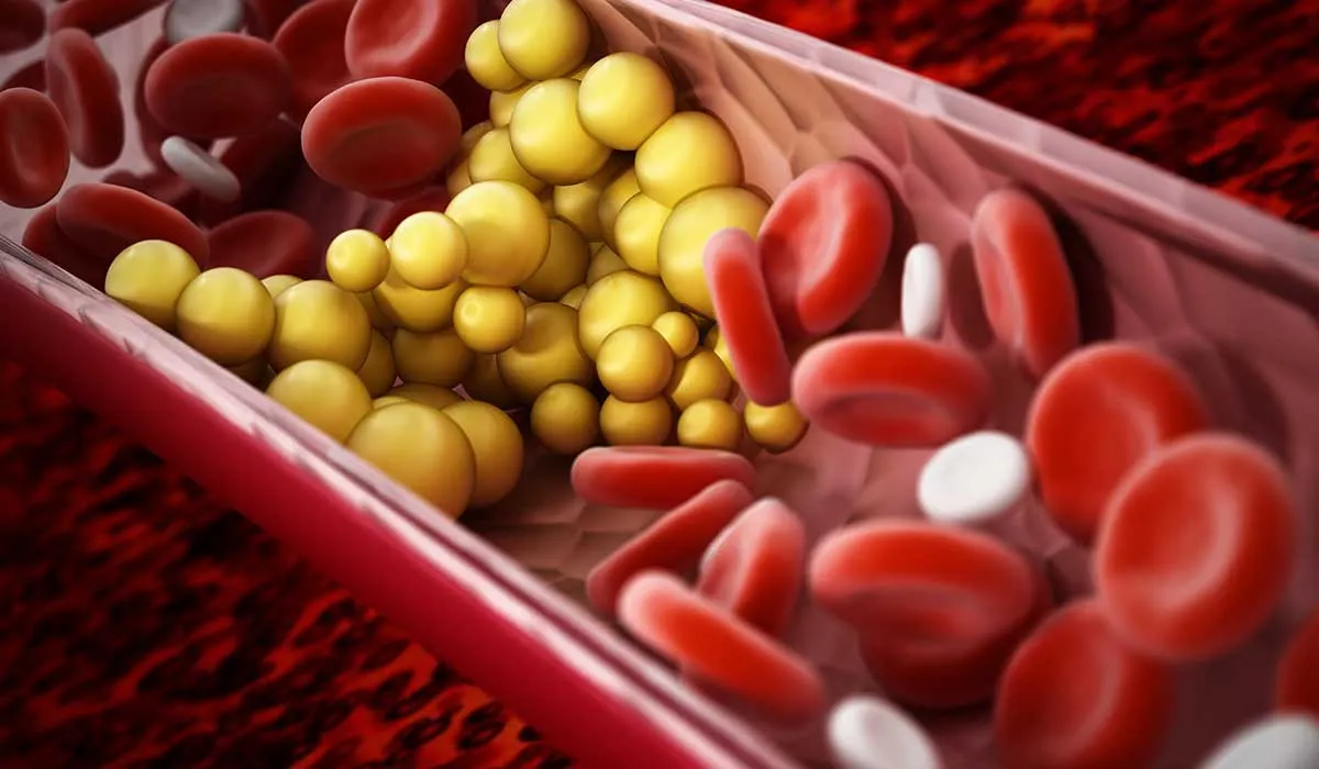 las mejores formas para reducir el colesterol