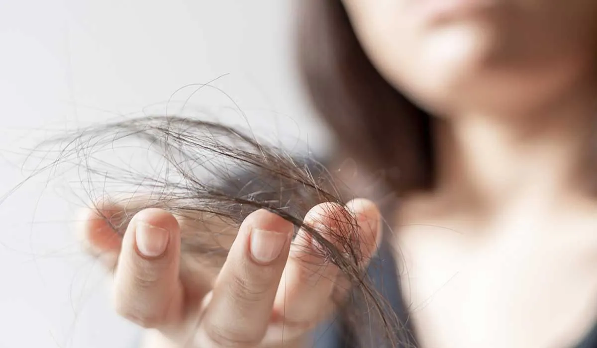 caida de cabello generada por el covid