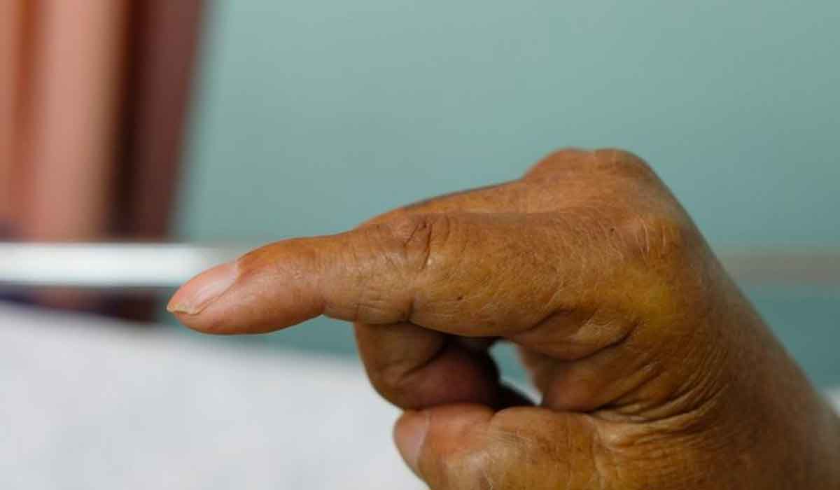 la condición de tus manos puede predecir enfermedades