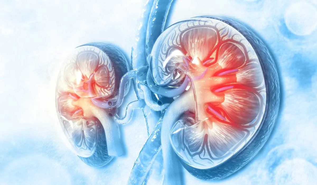 el cáncer de riñón es más frecuente en hombres