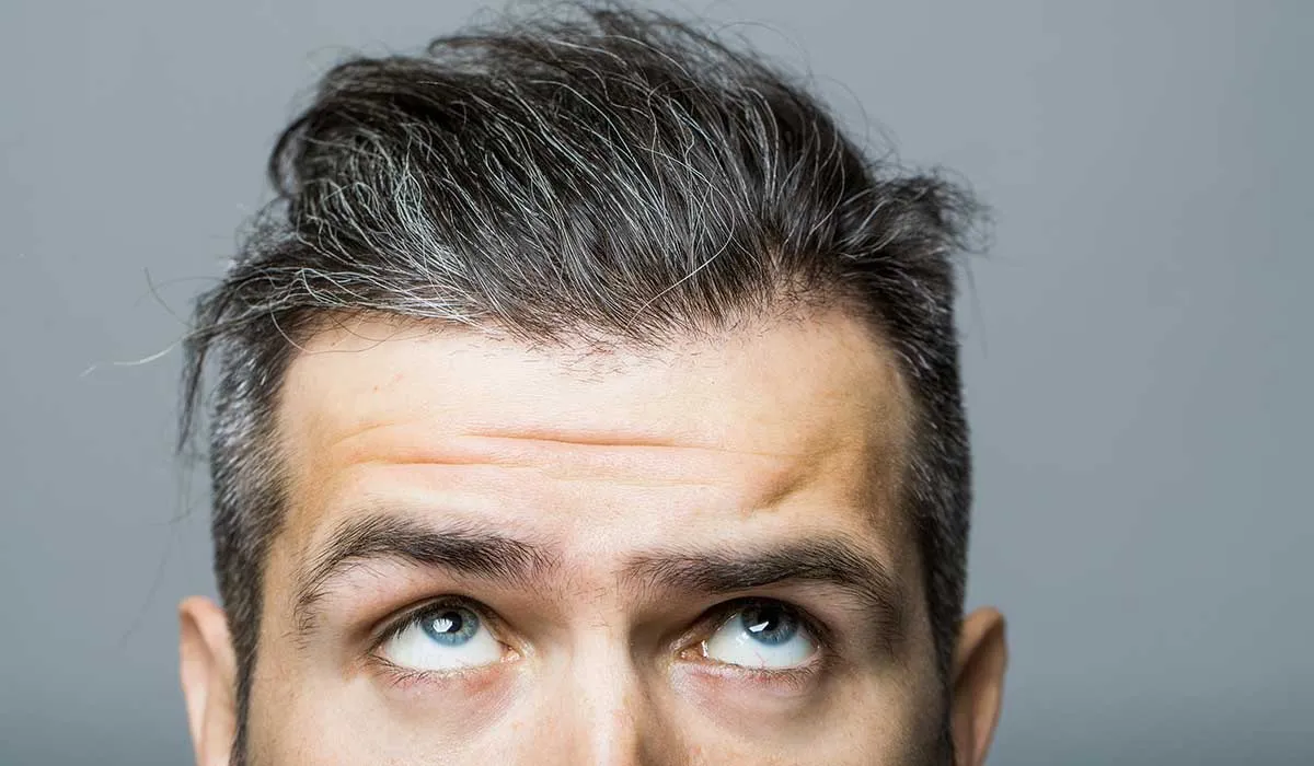 razones de por que te salen canas prematuramente