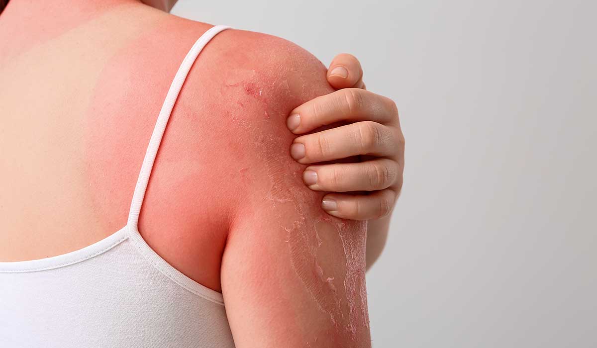 tu piel puede avisarte sobre diferentes enfermedades de tu cuerpo