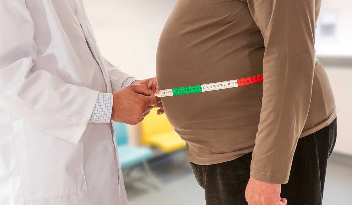 obesidad y sus cuatro diferentes tipos para tratarla