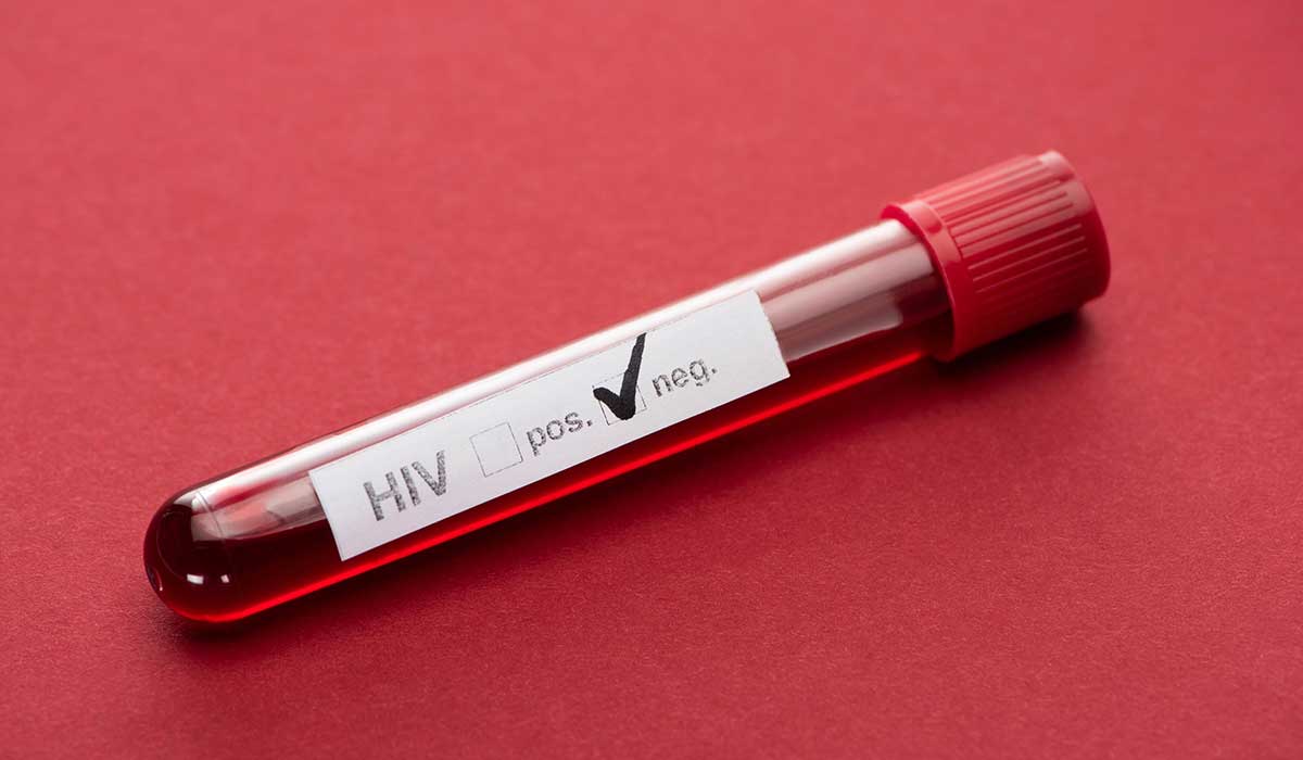 argentina se curó del VIH sin medicamentos