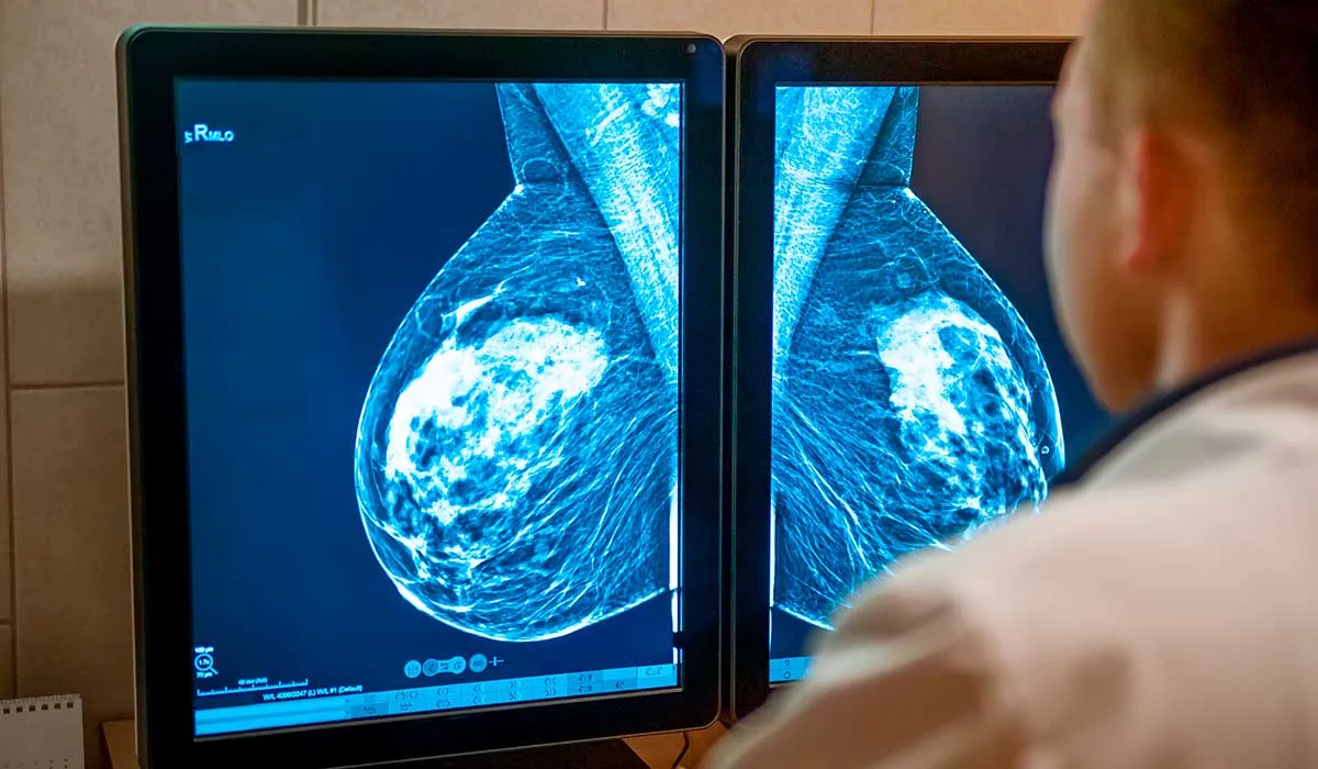 vacuna contra cáncer de mama