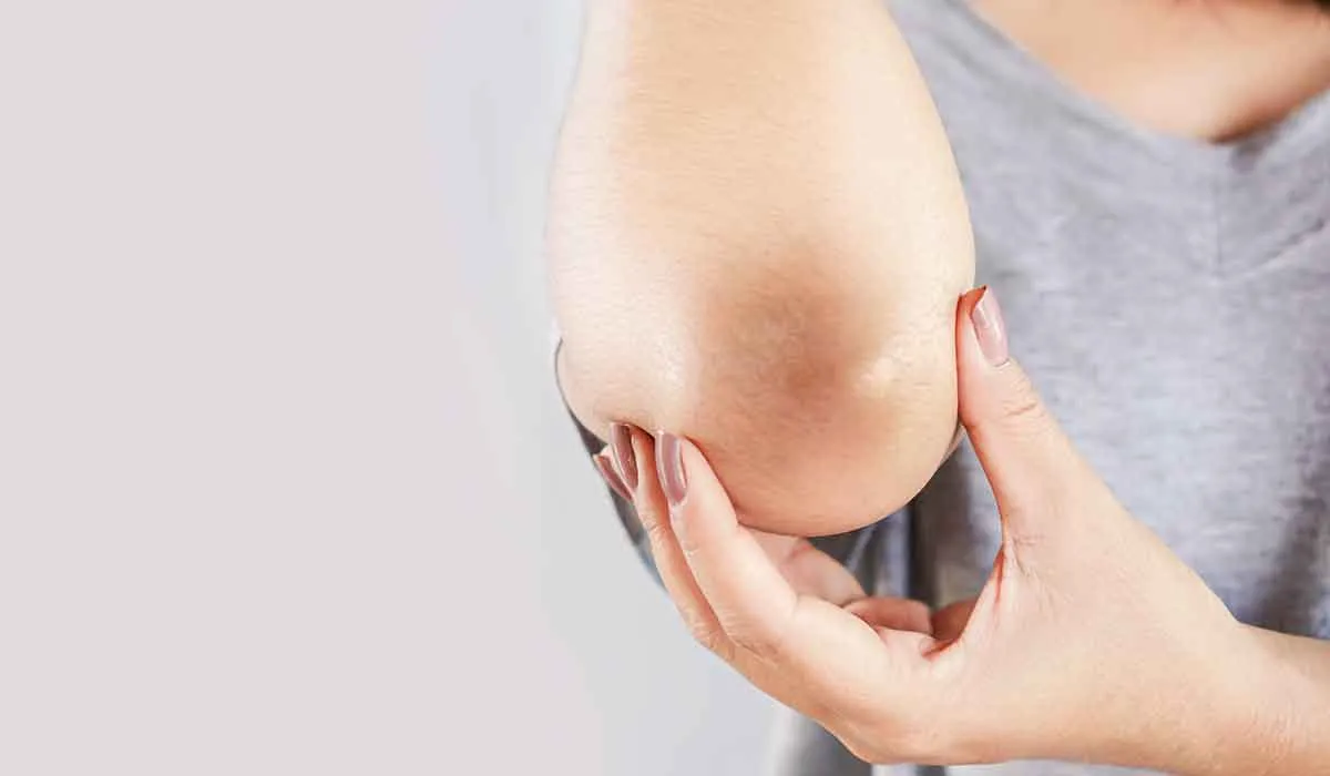 por qué la piel de los codos y las rodillas es diferente