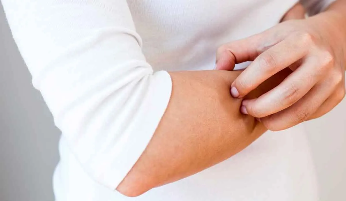 consejos para combatir la piel seca