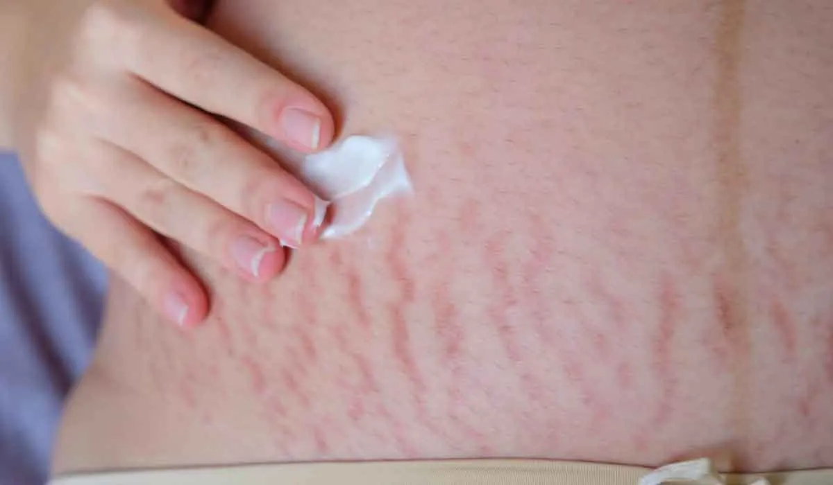 productos para la piel que puedes omitir porque son caros