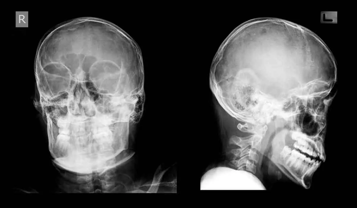 una prueba para comprobar si hay conmoción cerebral