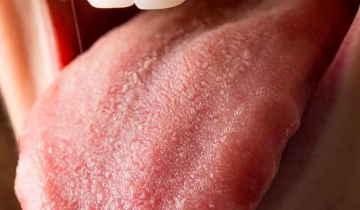 cáncer de piel que no está en la piel