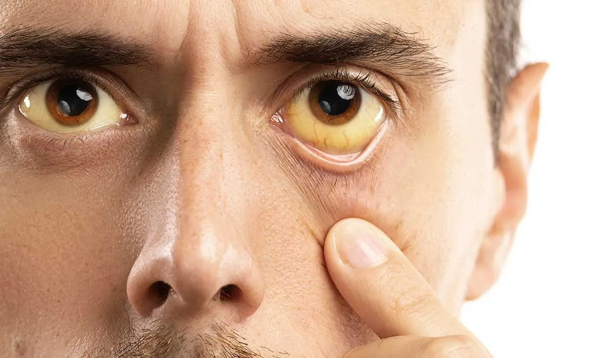 la importancia de la detección de la hepatitis C