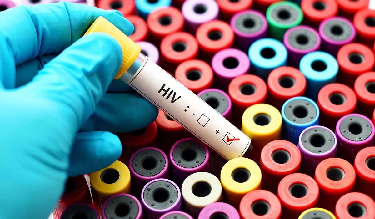 nuevas esperanzas reales contra el VIH