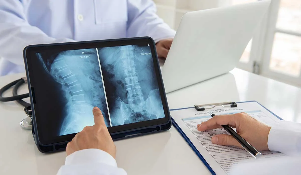 síntomas de hernia discal y dolor de espalda